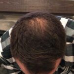 Have Hair Regrowing Spray photo review