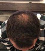 Have Hair Regrowing Spray - Image 3