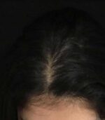 Have Hair Regrowing Spray - Image 5