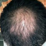 Have Hair Regrowing Spray photo review
