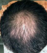 Have Hair Regrowing Spray - Image 2