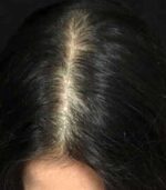 Have Hair Regrowing Spray - Image 4