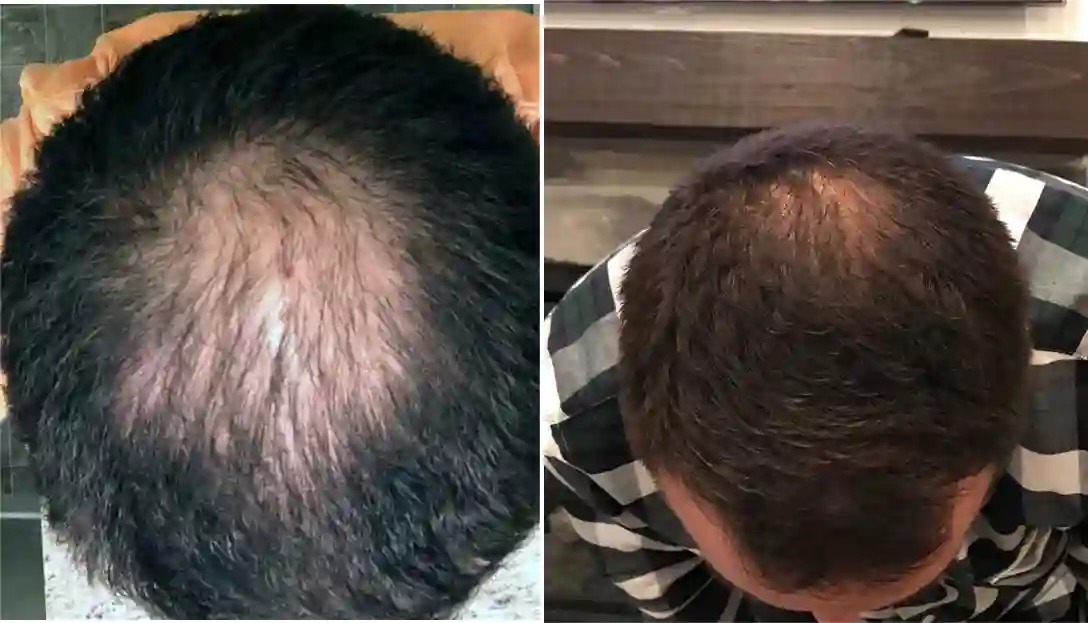 Have Hair Regrowing Spray photo review